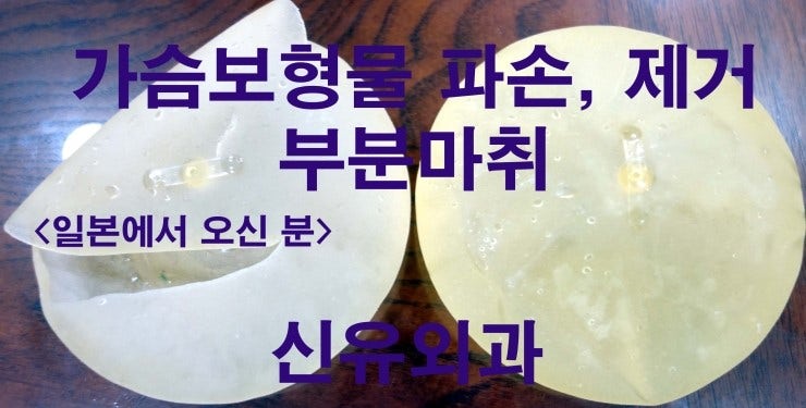 일본에서 오신, 가슴보형물파손으로 인한 제거수술후기 