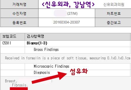 남자함몰유두수술전후사진과 후기 ; 봉합조차 하지 않는.