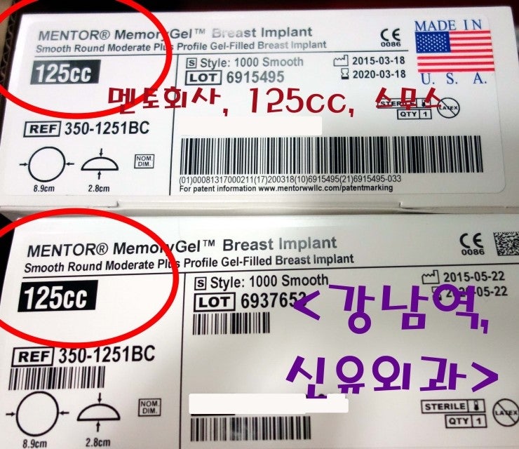 보형물파손, 제거후 3주만에 스무스보형물로 재삽입하신 분 후기.