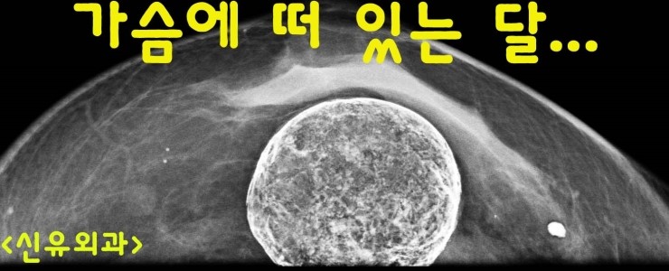 가슴에 품은 보름달...    (지방이식부작용석회화때문에)