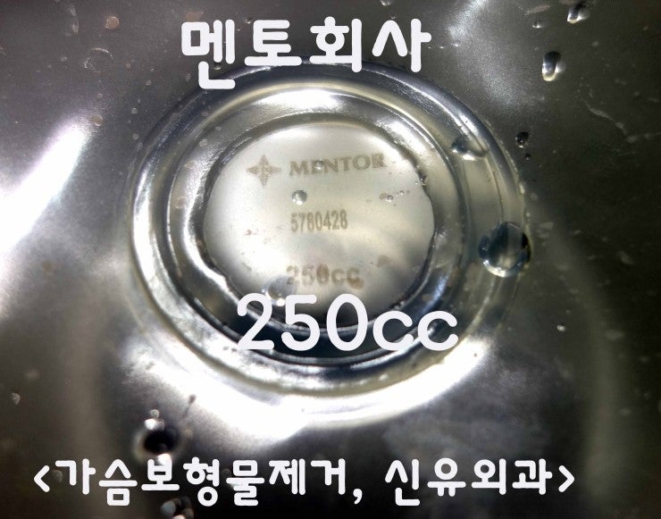 다른병원 여자 의사선생님 가슴보형물 8년만에 제거수술 후기