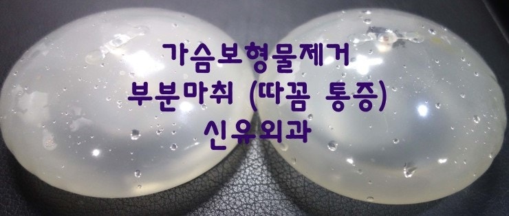 맑은 생리식염수를 품고 계셨던 가슴보형물제거수술후기 