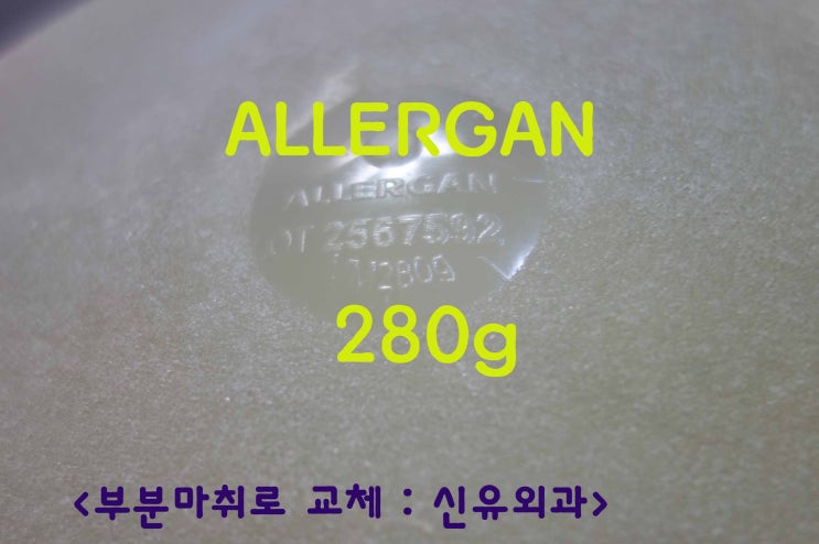 부분마취로 물방울보형물280cc를 스무스400cc로 교체한 분 : 수술중간에 본인 눈으로 확인하고 만져보시기까지 함.