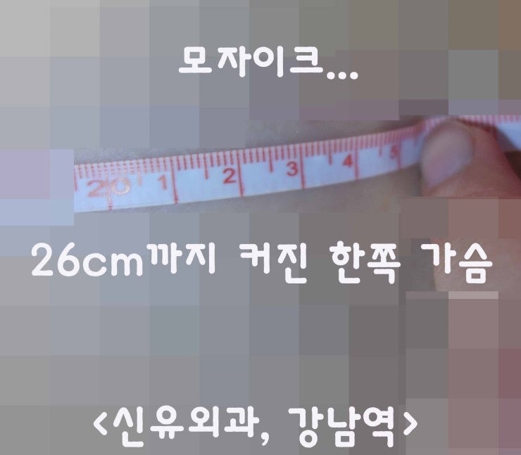 한쪽 가슴보형물파손으로 팽창되어 버린 가슴 --> 하이드로겔때문