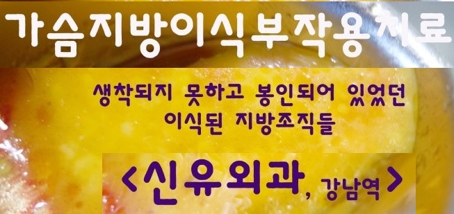 가슴지방이식--> 근육에 생착된 지방 실제사진 vs 구형구축처럼 피막이 두꺼워진 방 
