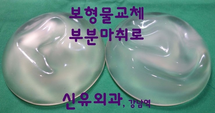 가슴보형물교체를 300cc에서 175cc로 부분마취로 수술했던 분