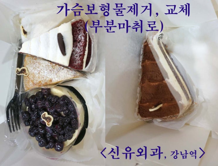 가슴보형물제거수술후 가져다 주신 스타벅스의 커피와 케이크들