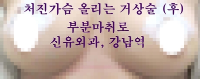 파손된 가슴보형물제거하고 처진가슴 올리는 거상술도 함께 부분마취로만.