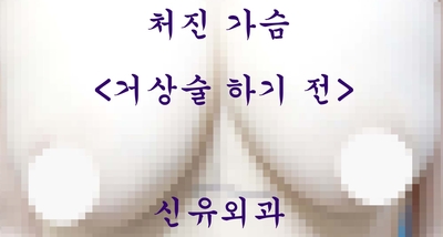 가슴보형물이 뒤집혀서 제거교체하고 처진가슴 끌어올리는 거상술도