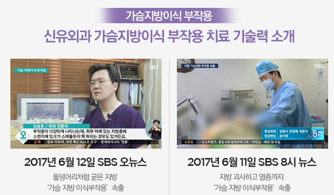 70E컵을 B컵으로 : 유방축소술 가슴축소수술 상담