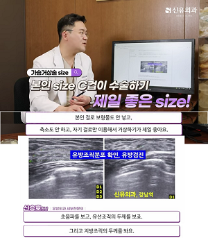 <신유외과> 가슴거상술-흉터를 최소화한 반달절개법으로!