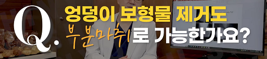 <신유외과> 엉덩이보형물제거도 부분마취로 가능한가요?