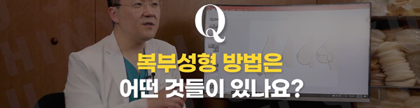 <신유외과> 복부성형은 어떤 방법들이 있나요?