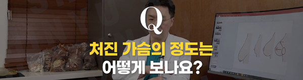 <신유외과> 처진가슴 정도는 어떻게 보나요?