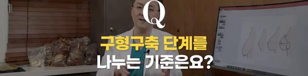 <신유외과> 구형구축 단계를 나누는 기준은?