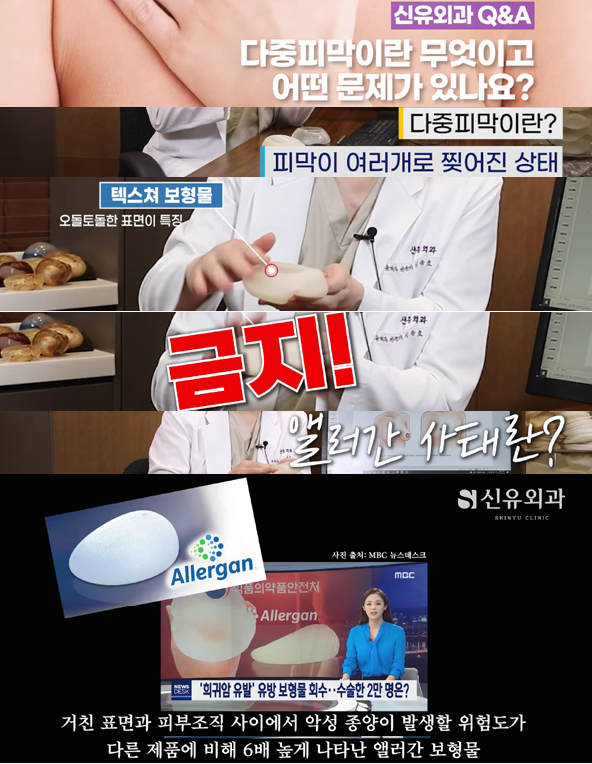 <신유외과> 다중피막이 뭔가요?