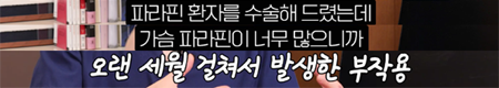 <신유외과> 작아서 무시했던 멍울이 0기 유방암이었다니!!