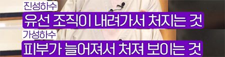 <신유외과> 가슴확대수술 너무 큰 보형물 넣으면 가슴이 처진다 (1)
