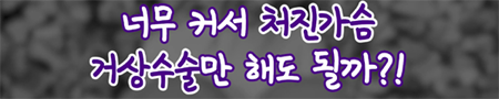 <신유외과> 가슴축소 NO! 볼륨 지키면서 처진가슴 살리는 법! (1)