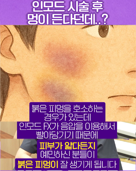 <신유피부클리닉> 인모드는 멍 들어야 효과있다??