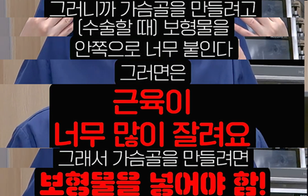 만약 유방이 옆으로 퍼져있다면 보형물 넣으셔야 됩니다. 사진 3
