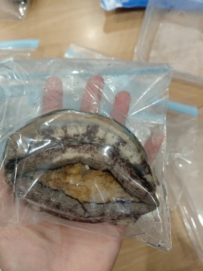 수술전날 보내주신 깜짝 선물 사진 6
