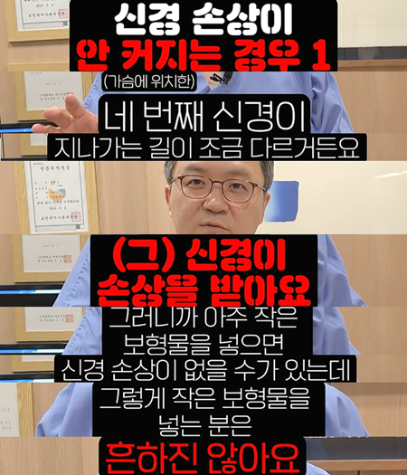 보형물 클수록 신경손상 부작용 확률 높아진다? 사진 2