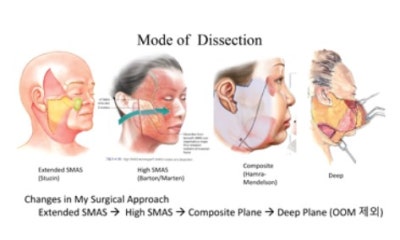 การผ่าตัดดึงหน้า สิ่งที่ต้องพิจารณาร่วมกับ SMAS คืออะไร - Integrated Tissue Control | Taylor Plastic Surgery
