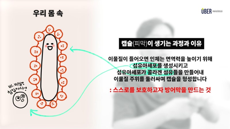 위버성형외과 서승조 원장님이 알려주는 코보형물제거에 대한 정보, 수술 후 부작용 또는 모양 불만족으로 고민이라면 주목해 주세요!