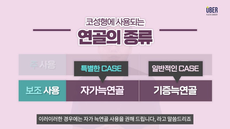 위버성형외과 코성형, 연골특집#3_자가늑연골의 장점과 단점, 언제 사용해야 하는지 알려드려요!