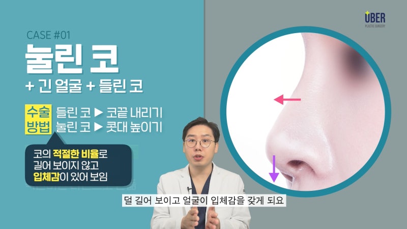 위버성형외과 서승조 원장님이 알려주는 긴코성형이 어려운 이유, 해결 방법까지 확인하세요!