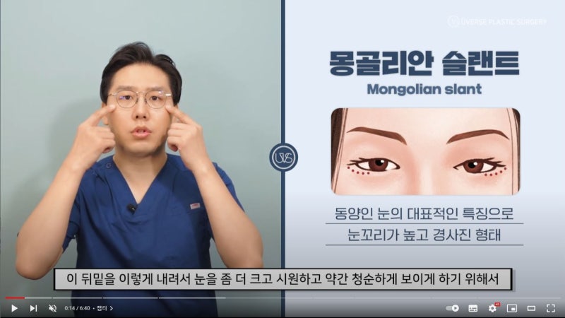 [Weverse Plastic Surgery] ทำความรู้จักประเภทและจุดสำคัญของการผ่าตัดเปิดหางตาและใต้ตา!
