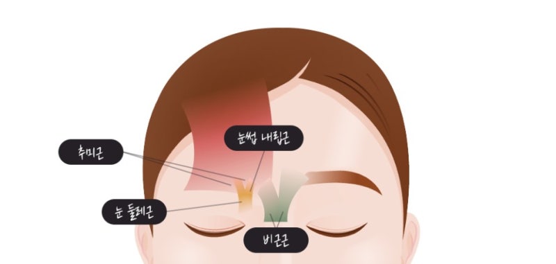 เครียดกับรอยย่นระหว่างคิ้วและหางตาตก การดึงหน้าผากช่วยแก้ไขได้ไหม?