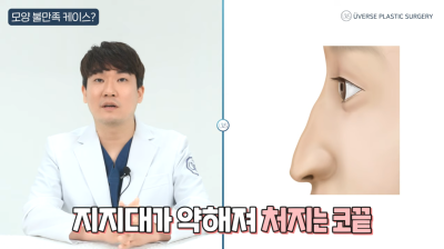 แก้ปัญหาทรงจมูกไม่ถูกใจทันที! ตั้งแต่ปลายจมูกตกไปจนถึงระยะเวลาที่เหมาะสมในการแก้จมูก!