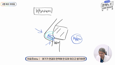 [บันทึกการบรรยายของโคซึงโจ] การเสริมผนังกั้นจมูก ตอนที่ 2