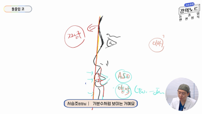 [บันทึกการบรรยายของโคซึงโจ] จมูกสำหรับปากยื่น