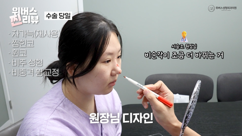 완벽한 옆태👃코재수술 [1탄]