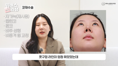 완벽한 옆태💖코재수술 [2탄]