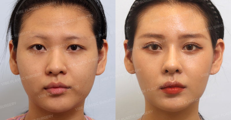 Câu chuyện THẬT 2