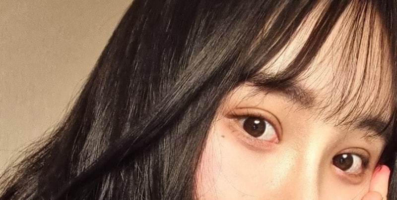 ผ่าตัดยกคิ้วผ่านกล้อง & แก้ไขกล้ามเนื้อตาแบบกรีด (หรือที่เรียกว่า 2 in 1 Fix-up Ptosis Correction)
