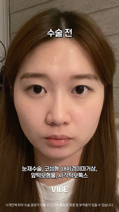 การเปลี่ยนแปลงที่สมบูรณ์แบบที่ VIBE Plastic Surgery! SHORTS!