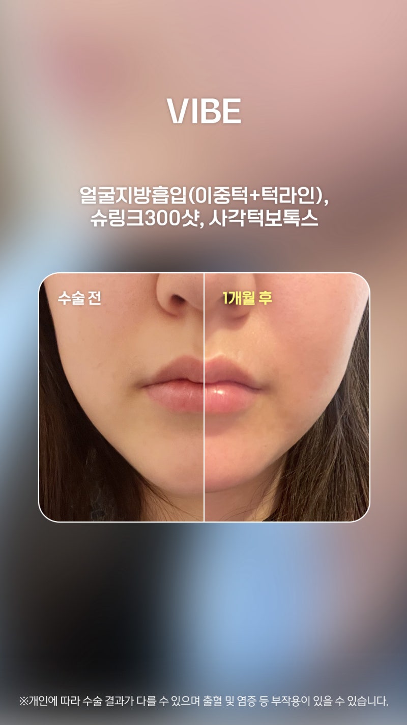 여러 각도에서 봐도 얄쌍해보이는 바이브 얼지흡!