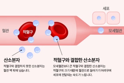 ✨고압산소치료, 수술 후 회복 관리의 새로운 선택지｜바이브성형외과에서 경험해보세요
