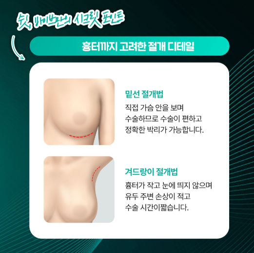 복숭아 가슴성형, 체형까지 고려한 맞춤 가슴성형｜신논현 바이브성형외과에서 만나보세요