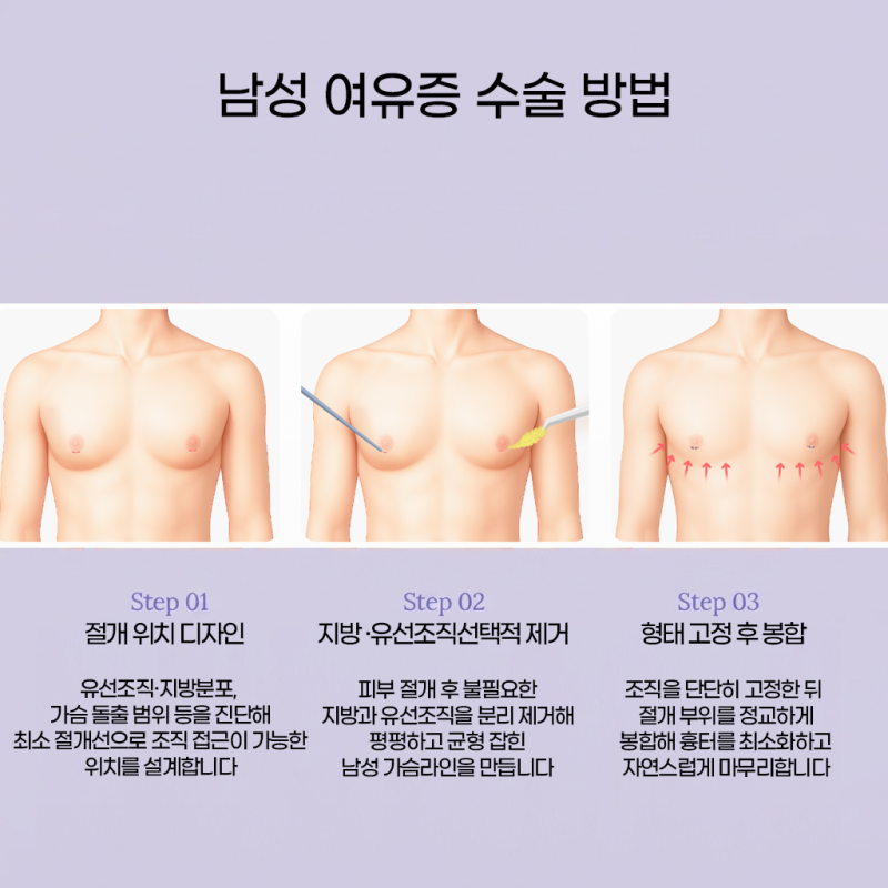 남성 여유증, 운동해도 그대로라면?! 신논현역 여유증 바이브성형외과에서 자세히 알려드립니다 사진 5