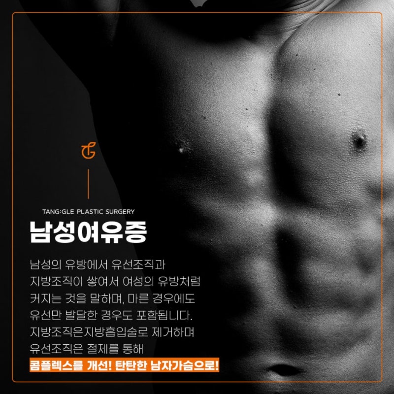 Gynecomastia: Causes and Treatment! 사진 2