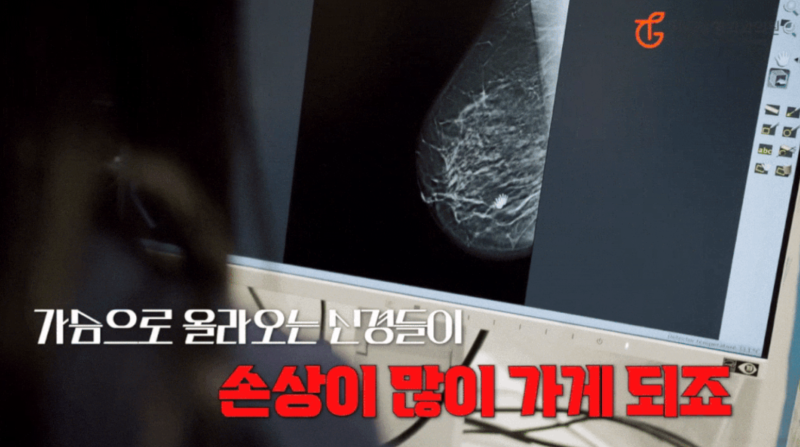 Sagging Breast Lift: Attention to Those Worried About Scars!