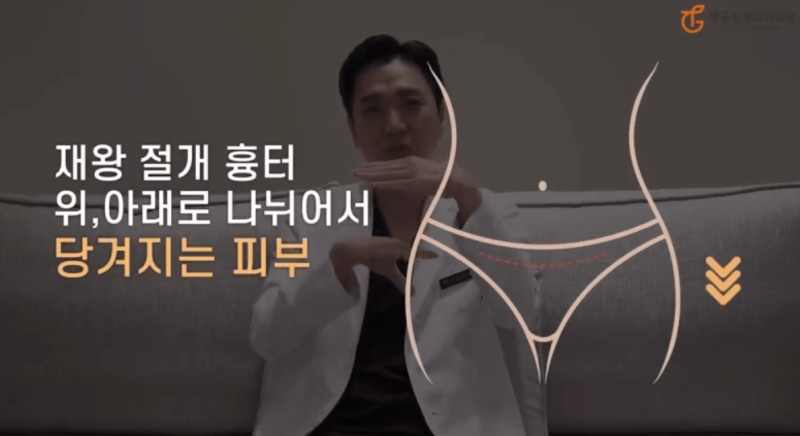 Tummy Tuck Cost: Hidden Risks of Cheap Clinics 사진 2