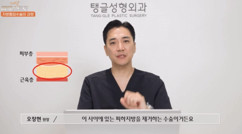 Abdominal Liposuction: Why Your Skin Might Be Uneven 3 Days Later 사진 2