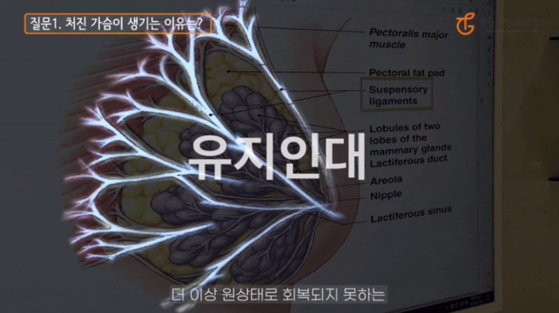 Breast Lift Surgery: Solutions for Sagging Breasts